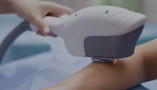 Maszyna laserowa IPL