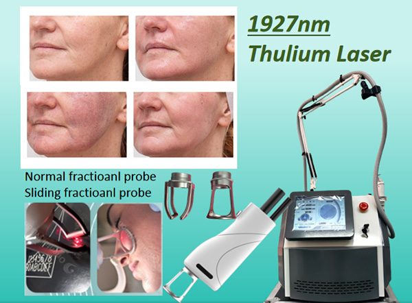 Fractional laser